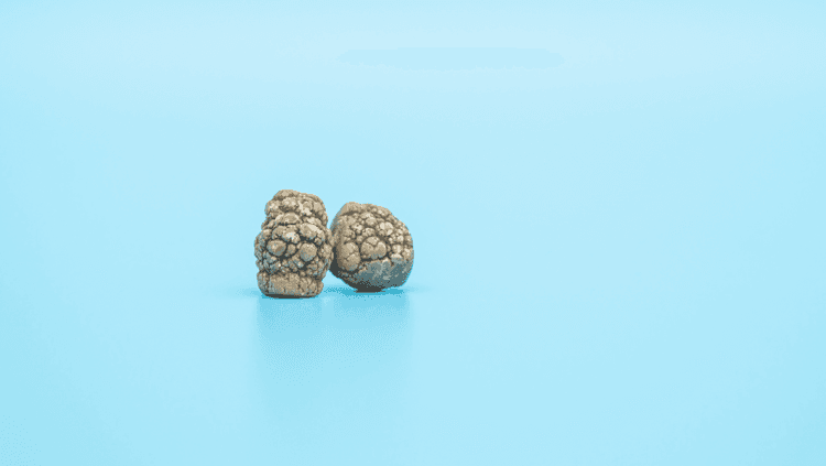 Most people with gallstones can take Mounjaro safely. UK guide on risks, how to minimise complications, and when to seek medical help.