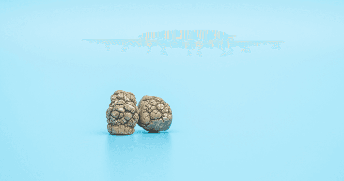 Can you take Wegovy if you have gallstones?